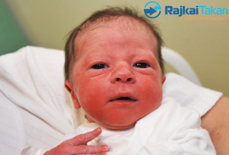 Nagy Edvárd, 2780 gr. Mosonmagyaróvár