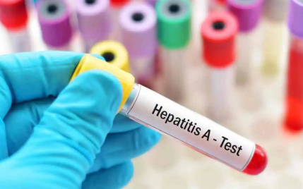 Népegészségügyi központ: dinamikusan emelkedik a hepatitis A-val fertőzöttek száma