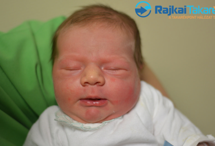 Renge Hunor, 4290 gr. Kimle